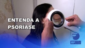 Psoríase: Conscientização sobre doença crônica de pele