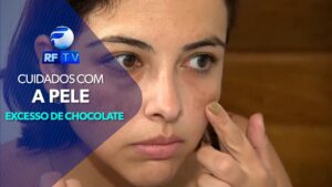 Dermatologista fala sobre riscos do consumo excessivo de chocolate